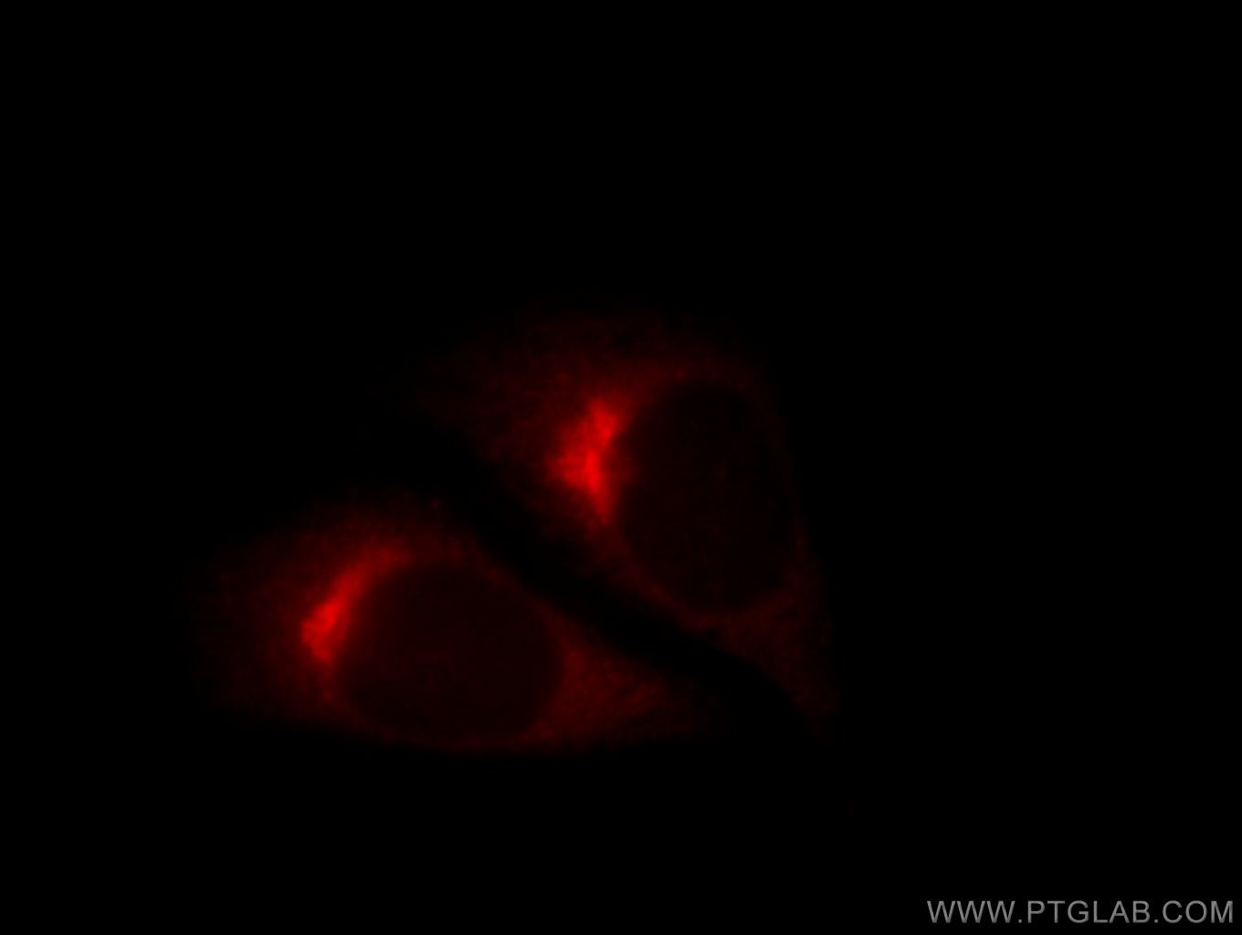 IF Staining of HepG2 using 11457-1-AP