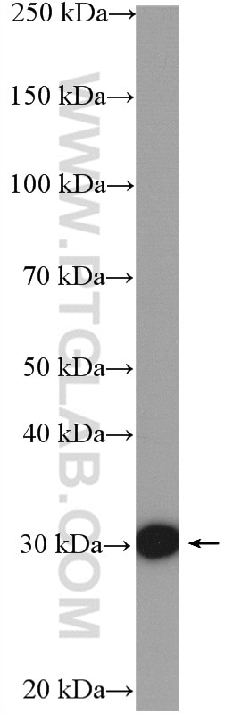 Western Blot (WB) analysis of A375 cells using COPE Polyclonal antibody (11457-1-AP)