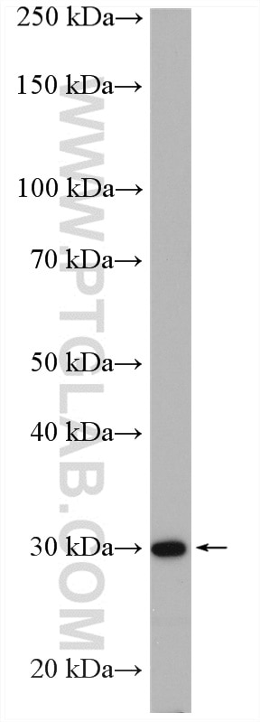 Western Blot (WB) analysis of A431 cells using COPE Polyclonal antibody (11457-1-AP)