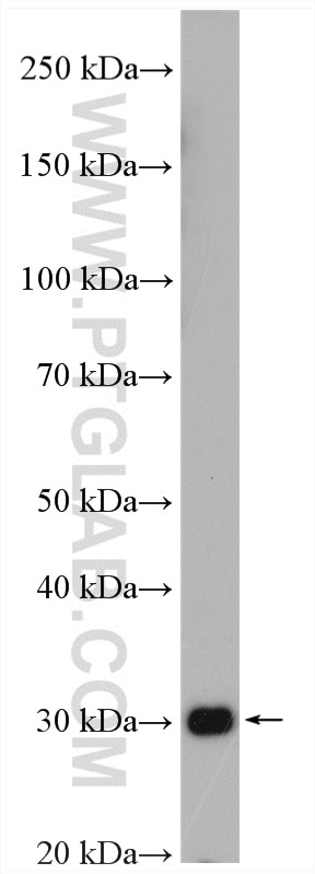 Western Blot (WB) analysis of MCF-7 cells using COPE Polyclonal antibody (11457-1-AP)