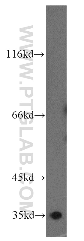 Western Blot (WB) analysis of PC-3 cells using COPE Polyclonal antibody (11457-1-AP)