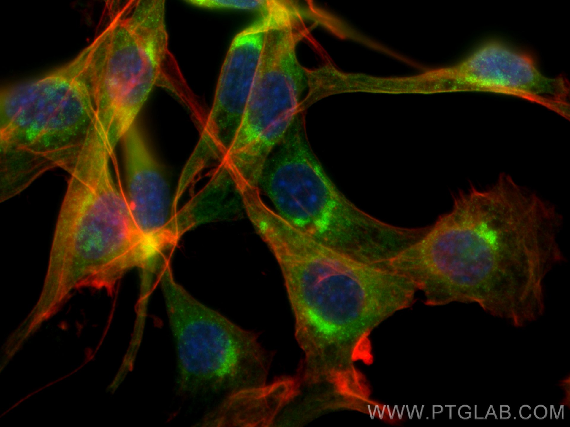 IF Staining of NIH/3T3 using 12393-1-AP