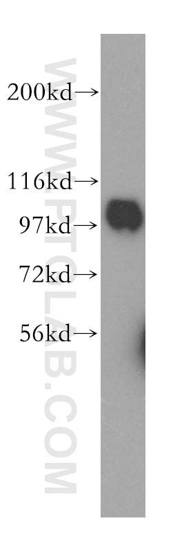 Western Blot (WB) analysis of A375 cells using COPG Polyclonal antibody (12393-1-AP)