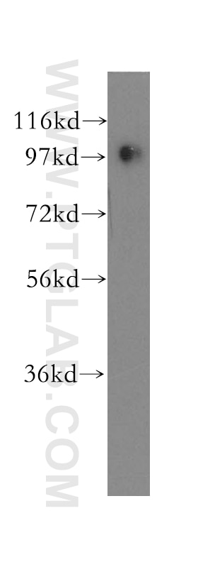 WB analysis of human colon using 12393-1-AP