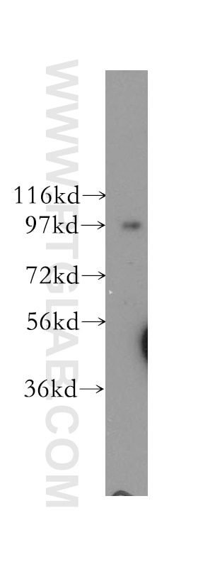 Western Blot (WB) analysis of human brain tissue using COPG Polyclonal antibody (12393-1-AP)