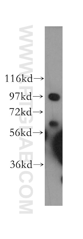 Western Blot (WB) analysis of HeLa cells using COPG Polyclonal antibody (12393-1-AP)