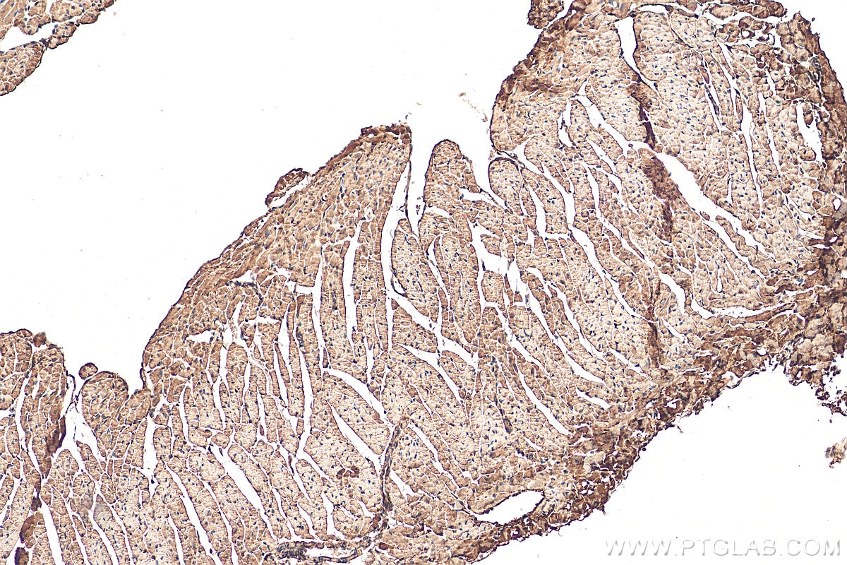 Immunohistochemistry (IHC) staining of mouse heart tissue using COPG2 Polyclonal antibody (16111-1-AP)