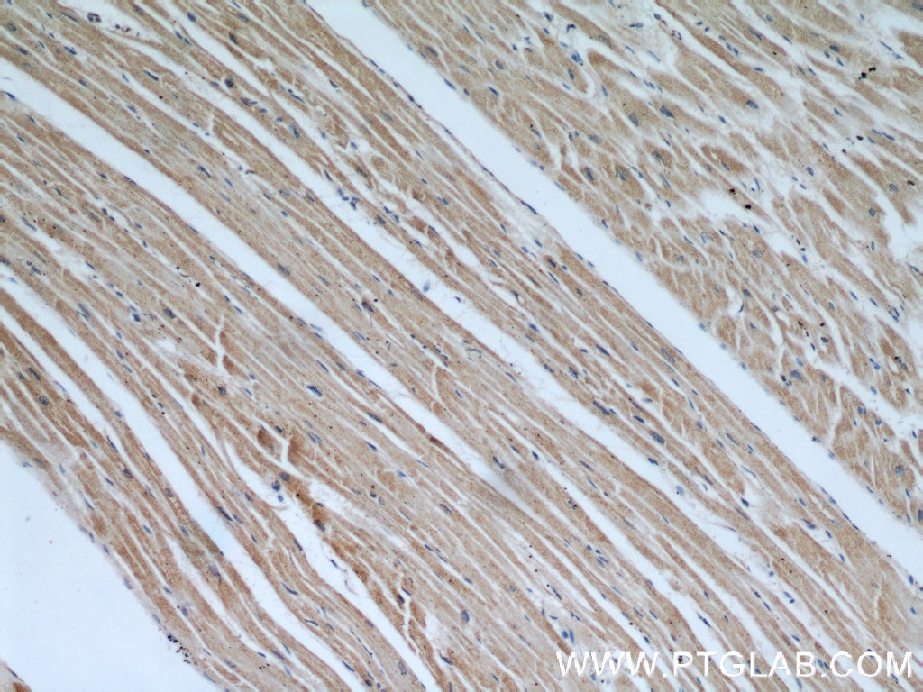 Immunohistochemistry (IHC) staining of human heart tissue using COPG2 Polyclonal antibody (16111-1-AP)