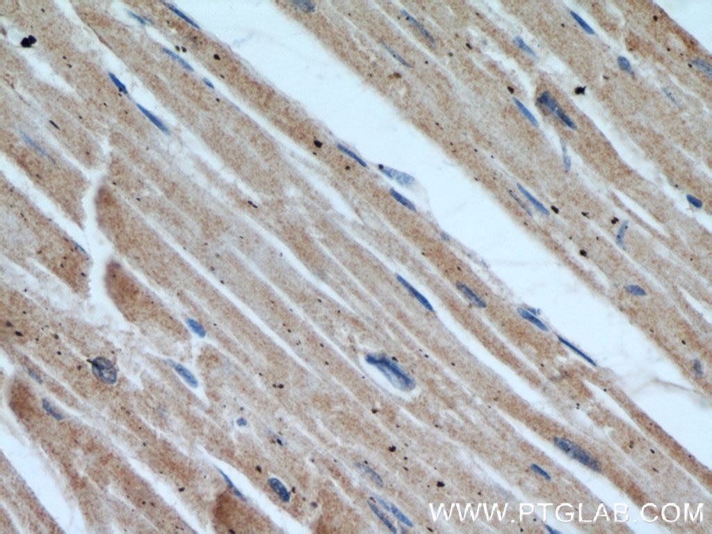 Immunohistochemistry (IHC) staining of human heart tissue using COPG2 Polyclonal antibody (16111-1-AP)