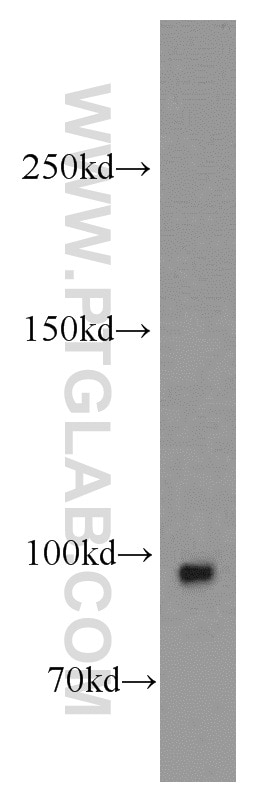 Western Blot (WB) analysis of mouse brain tissue using COPG2 Polyclonal antibody (16111-1-AP)