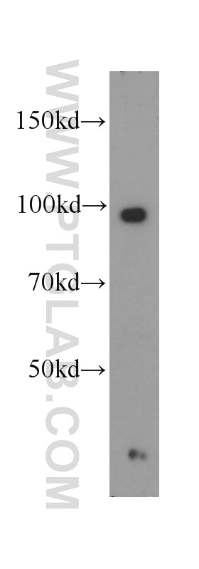 Western Blot (WB) analysis of mouse heart tissue using COPG2 Polyclonal antibody (16111-1-AP)