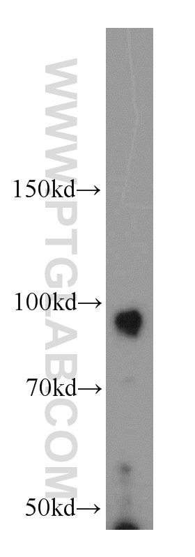Western Blot (WB) analysis of HeLa cells using COPG2 Polyclonal antibody (16111-1-AP)