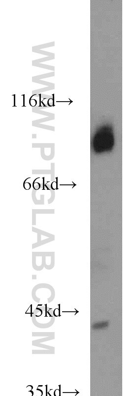 Western Blot (WB) analysis of human heart tissue using COPG2 Polyclonal antibody (16111-1-AP)