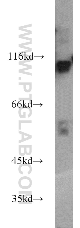 WB analysis of human skeletal muscle using 16111-1-AP