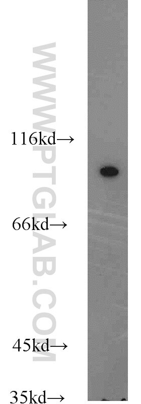 Western Blot (WB) analysis of mouse kidney tissue using COPG2 Polyclonal antibody (16111-1-AP)