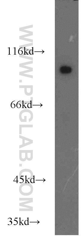 Western Blot (WB) analysis of mouse heart tissue using COPG2 Polyclonal antibody (16111-1-AP)