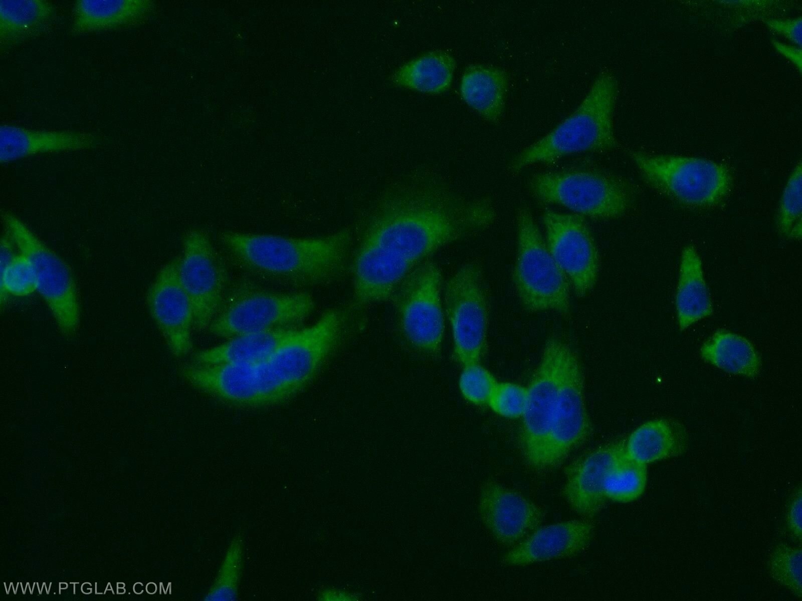 Immunofluorescence (IF) / fluorescent staining of HeLa cells using CSN2 Polyclonal antibody (10969-2-AP)
