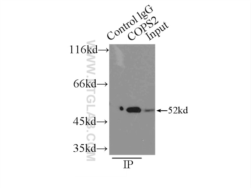 Immunoprecipitation (IP) experiment of NIH/3T3 cells using CSN2 Polyclonal antibody (10969-2-AP)