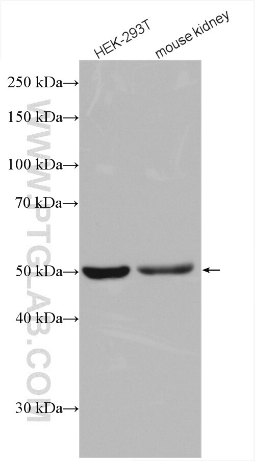 Western Blot (WB) analysis of various lysates using CSN2 Polyclonal antibody (10969-2-AP)