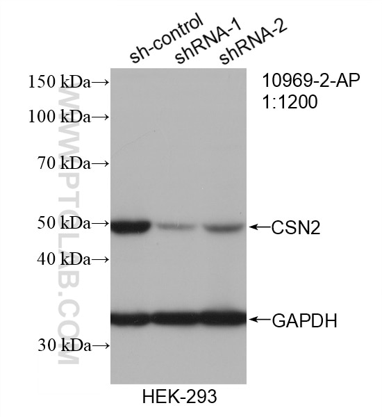 Western Blot (WB) analysis of HEK-293 cells using CSN2 Polyclonal antibody (10969-2-AP)