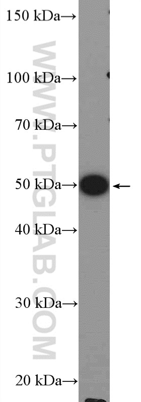 Western Blot (WB) analysis of HeLa cells using CSN2 Polyclonal antibody (10969-2-AP)