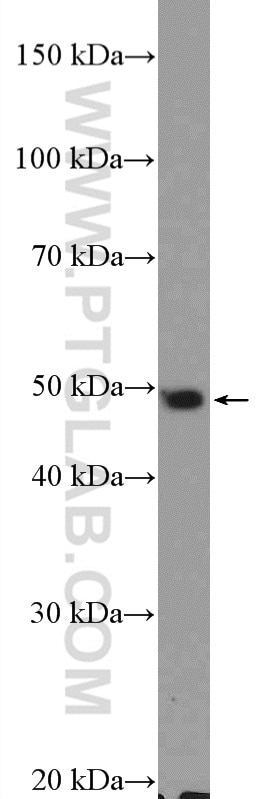 Western Blot (WB) analysis of mouse brain tissue using CSN2 Polyclonal antibody (10969-2-AP)