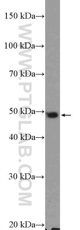 WB analysis of mouse brain using 10969-2-AP