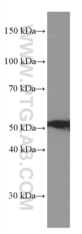 Western Blot (WB) analysis of ROS1728 cells using CSN2 Monoclonal antibody (66435-1-Ig)