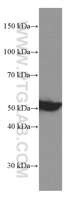 Western Blot (WB) analysis of RAW 264.7 cells using CSN2 Monoclonal antibody (66435-1-Ig)