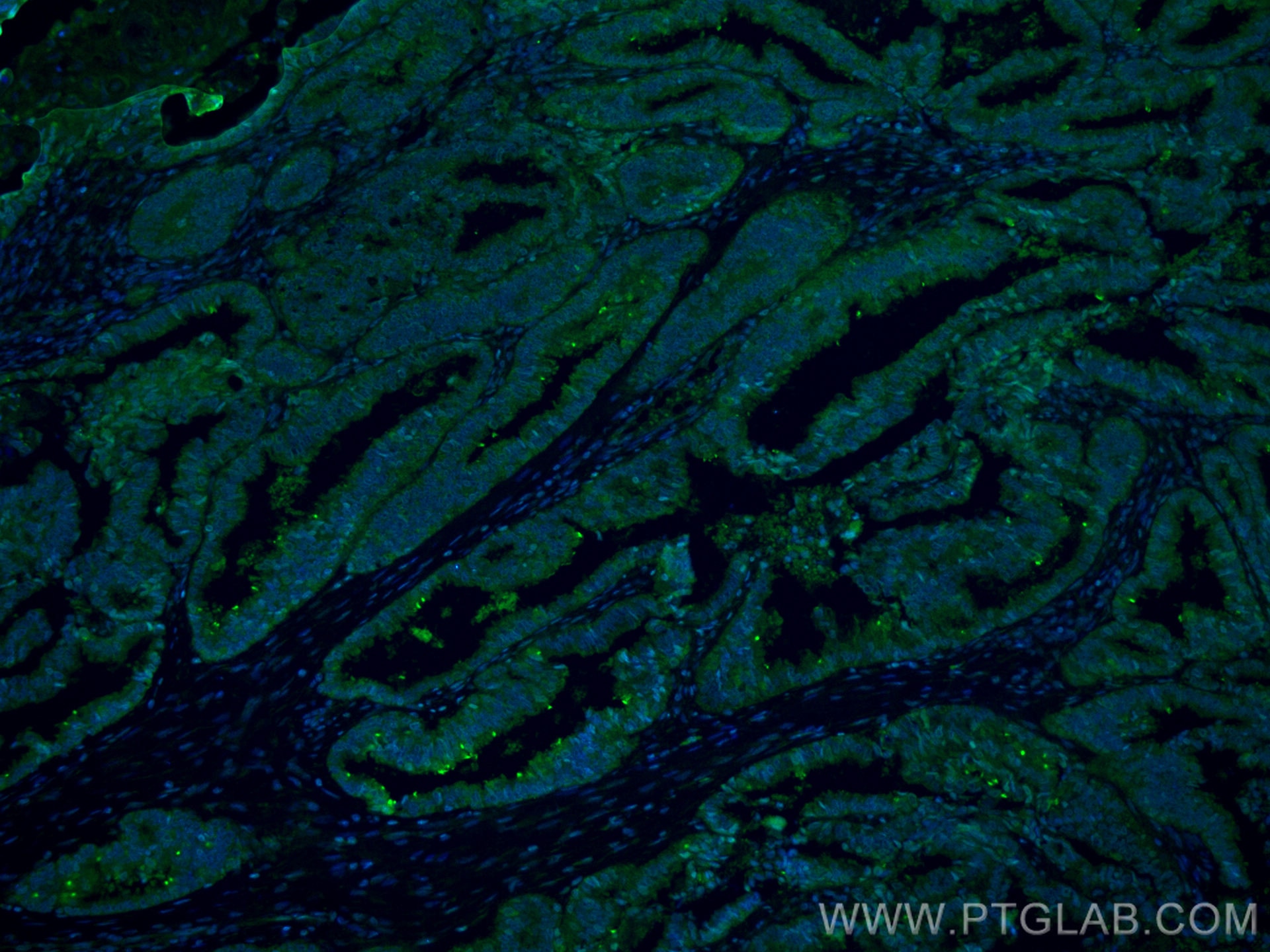 Immunofluorescence (IF) / fluorescent staining of human ovary cancer cells using CoraLite® Plus 488-conjugated COPS2 Monoclonal ant (CL488-66435)