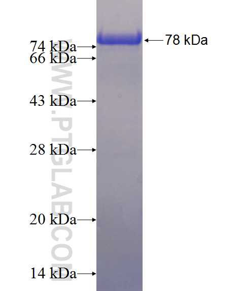 COPS2 fusion protein Ag1415 SDS-PAGE
