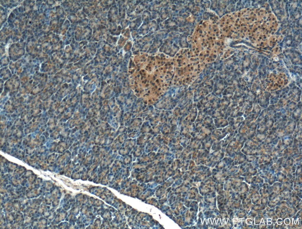Immunohistochemistry (IHC) staining of human pancreas tissue using COPS4 Polyclonal antibody (10464-1-AP)