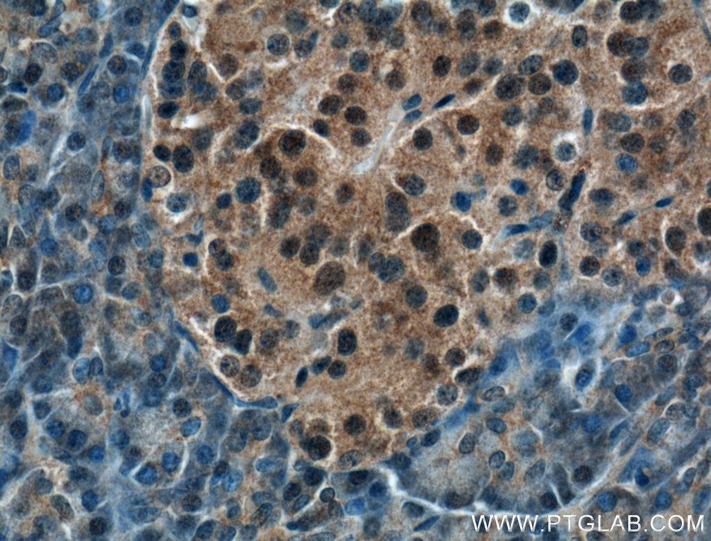 Immunohistochemistry (IHC) staining of human pancreas tissue using COPS4 Polyclonal antibody (10464-1-AP)