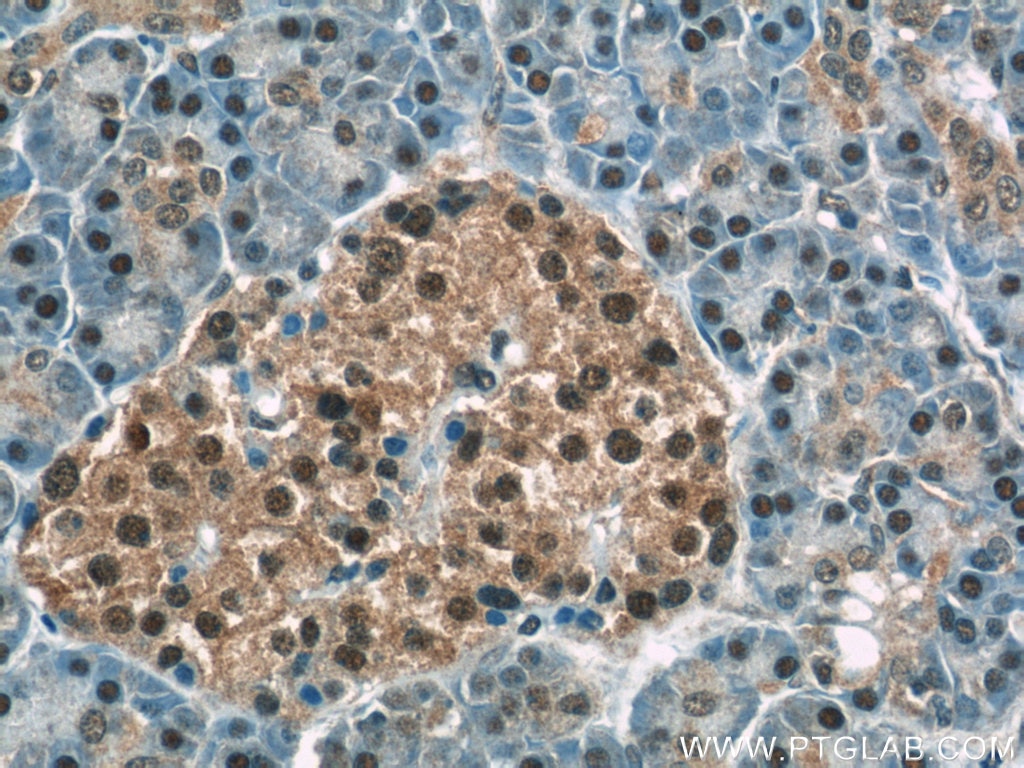 Immunohistochemistry (IHC) staining of human pancreas tissue using COPS4 Polyclonal antibody (10464-1-AP)