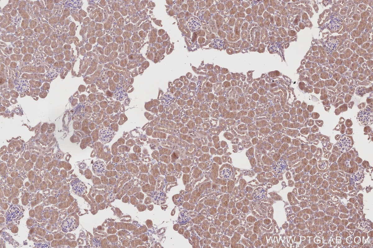 Immunohistochemistry (IHC) staining of mouse kidney tissue using COPS4 Polyclonal antibody (10464-1-AP)