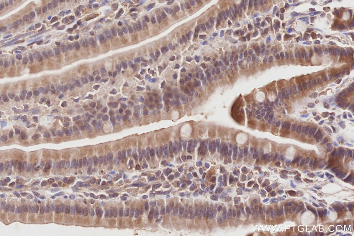 Immunohistochemistry (IHC) staining of mouse small intestine tissue using COPS4 Polyclonal antibody (10464-1-AP)