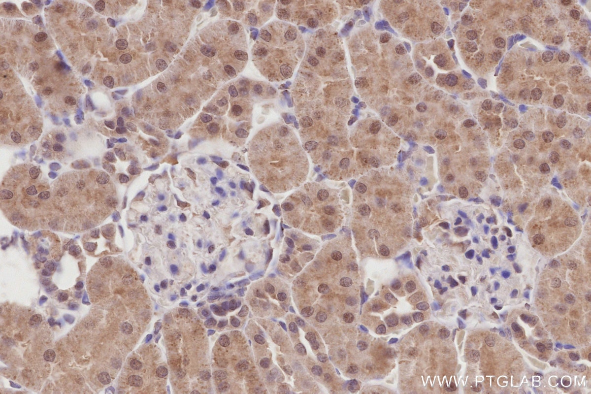 Immunohistochemistry (IHC) staining of rat kidney tissue using COPS4 Polyclonal antibody (10464-1-AP)