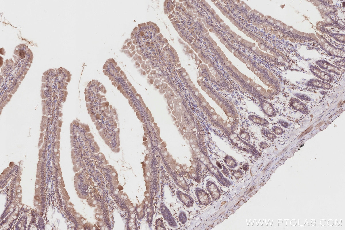 Immunohistochemistry (IHC) staining of rat small intestine tissue using COPS4 Polyclonal antibody (10464-1-AP)