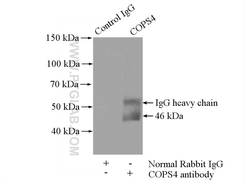 Immunoprecipitation (IP) experiment of PC-3 cells using COPS4 Polyclonal antibody (10464-1-AP)