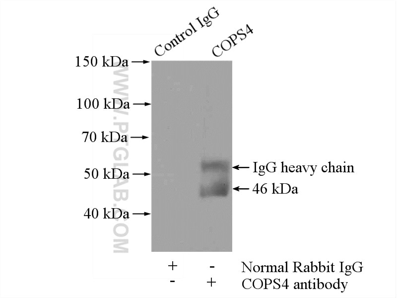 IP experiment of PC-3 using 10464-1-AP