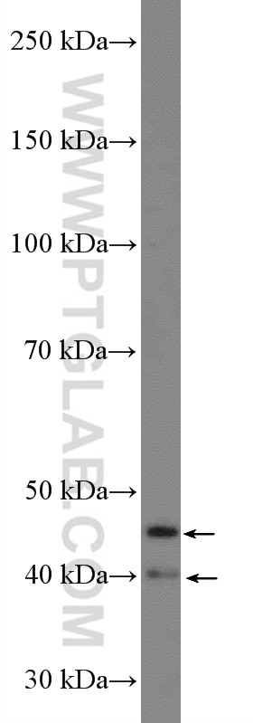 Western Blot (WB) analysis of mouse brain tissue using COPS4 Polyclonal antibody (10464-1-AP)