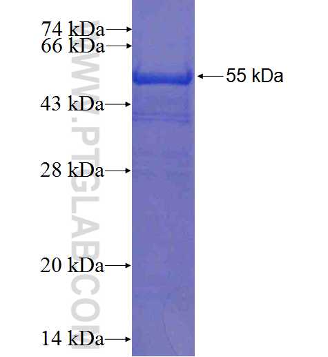 COPS4 fusion protein Ag0735 SDS-PAGE