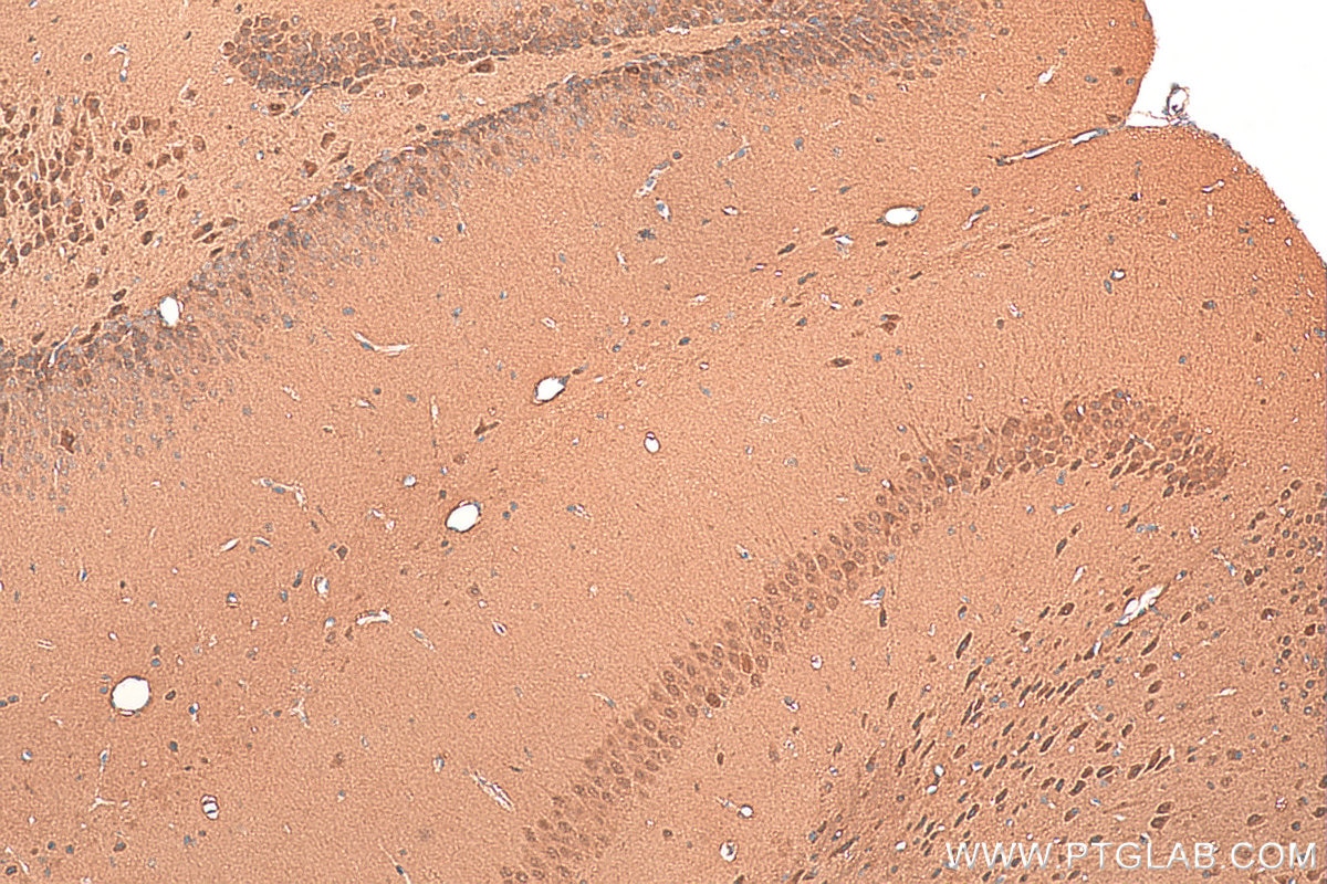 IHC staining of mouse brain using 16628-1-AP