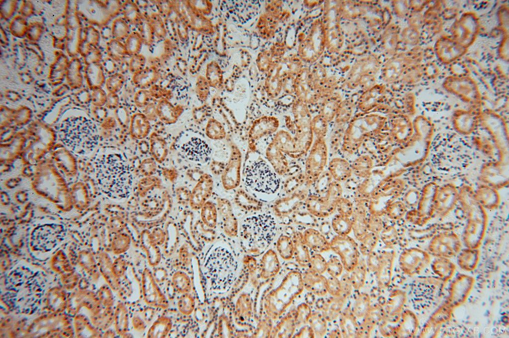 Immunohistochemistry (IHC) staining of human kidney tissue using COPS7A Polyclonal antibody (16628-1-AP)