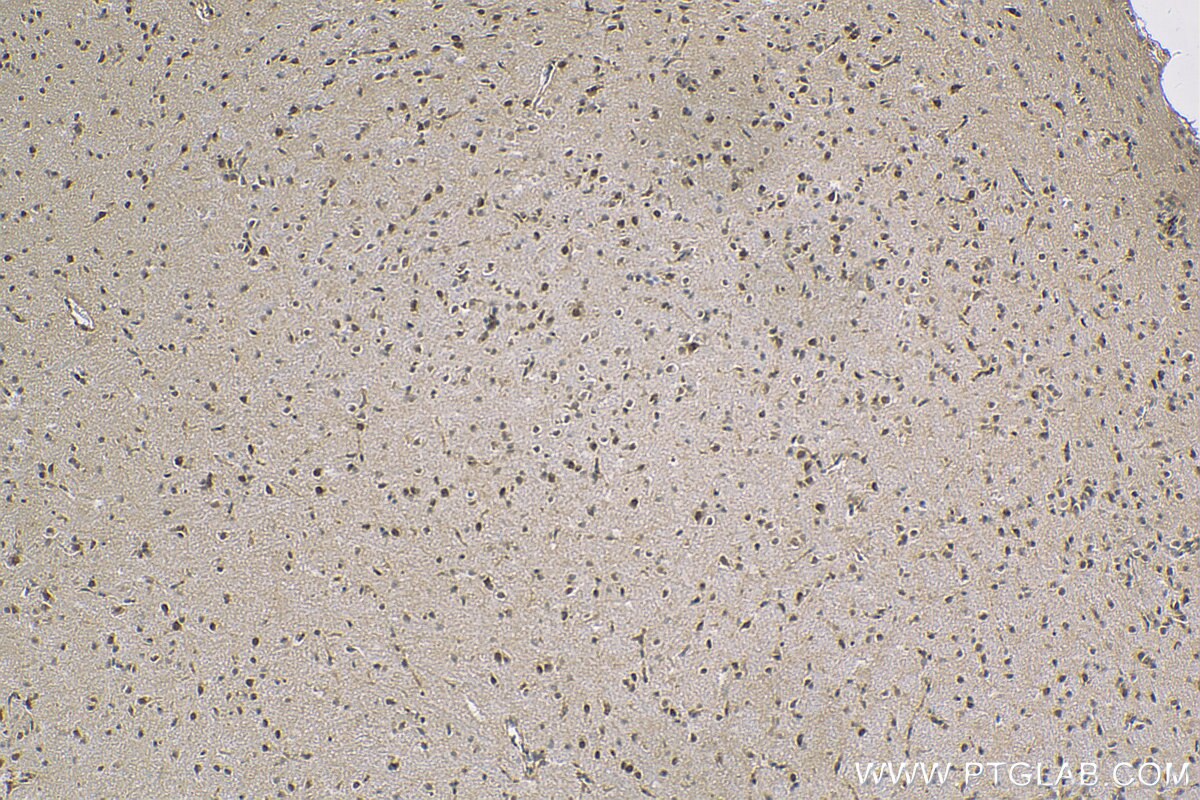 Immunohistochemistry (IHC) staining of mouse brain tissue using COPS8/COP9 Polyclonal antibody (10089-2-AP)