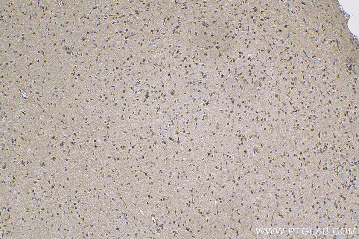 Immunohistochemistry (IHC) staining of mouse brain tissue using COPS8/COP9 Polyclonal antibody (10089-2-AP)