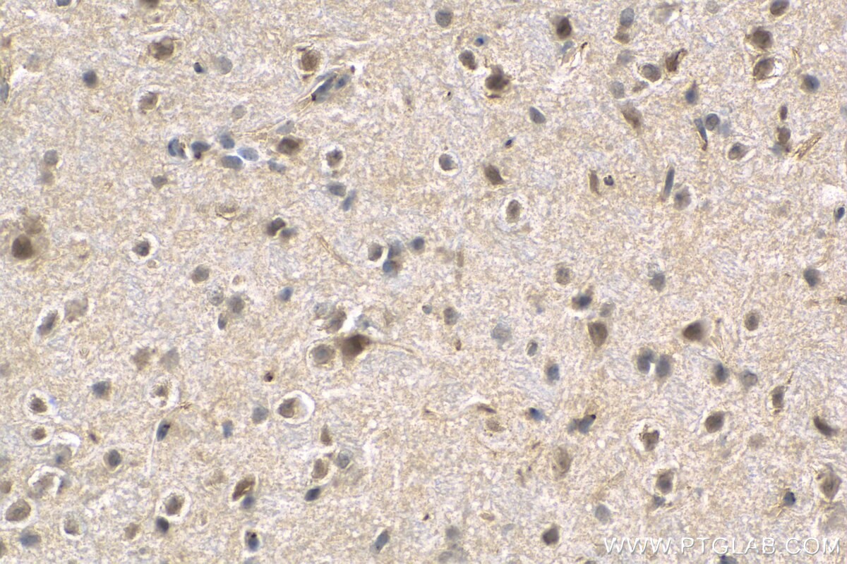 IHC staining of mouse brain using 10089-2-AP