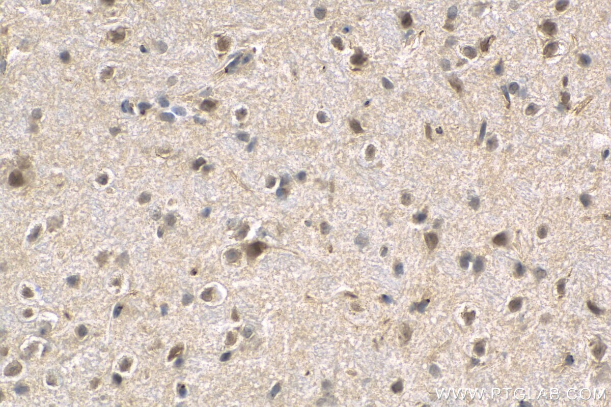 Immunohistochemistry (IHC) staining of mouse brain tissue using COPS8/COP9 Polyclonal antibody (10089-2-AP)