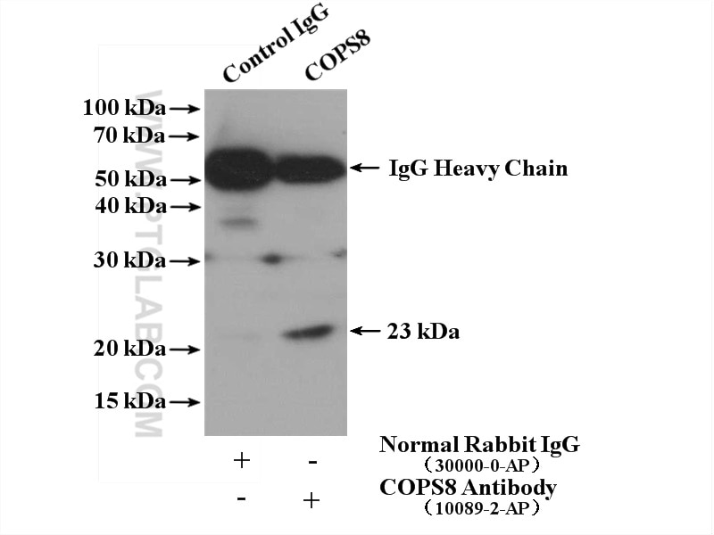 Immunoprecipitation (IP) experiment of mouse brain tissue using COPS8/COP9 Polyclonal antibody (10089-2-AP)