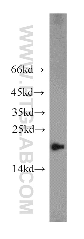 Western Blot (WB) analysis of Jurkat cells using COPZ1 Polyclonal antibody (20440-1-AP)